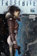 Frostbite / Обморожение